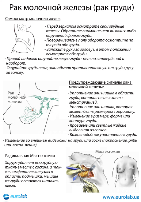 Курсовая Работа На Тему Рак Молочной Железы