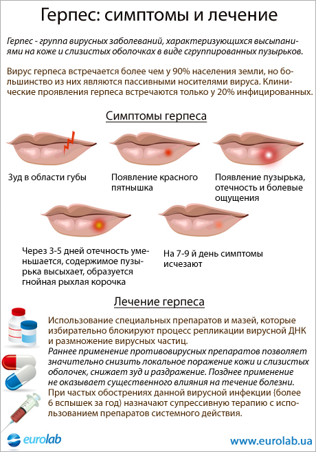 Что намазать на герпес в домашних условиях Что намазать на герпес в домашних условиях