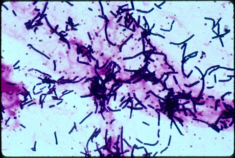 Bacillus cereus что это такое. Смотреть фото Bacillus cereus что это такое. Смотреть картинку Bacillus cereus что это такое. Картинка про Bacillus cereus что это такое. Фото Bacillus cereus что это такое