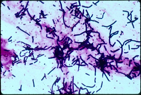 Bacillus cereus