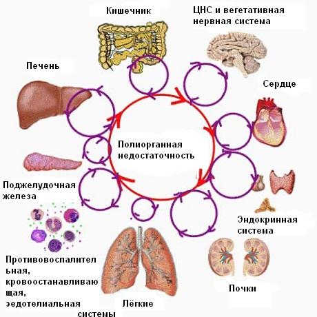 Полиорганная недостаточность