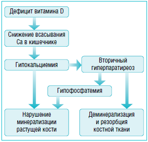 Рахит у детей