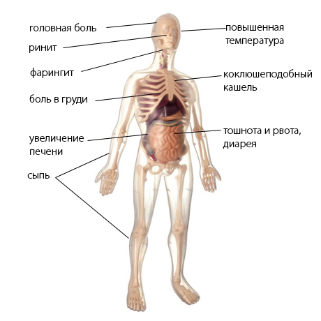 Микоплазмоз у детей