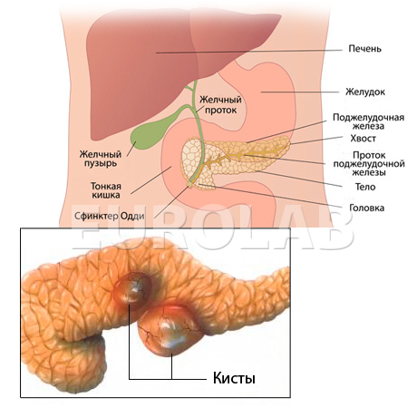 Киста Поджелудочной Железы Лечение Питание Диета