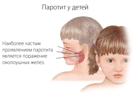 нарушение сна у детей в год нарушение сна у детей в год