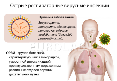 заболевания суставов после простуды гриппа заболевания суставов после простуды гриппа
