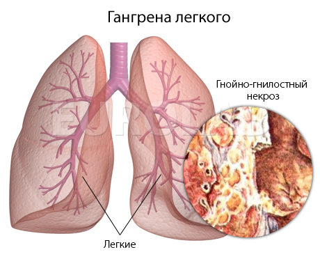 Возврате подоходного налога за лечение детей