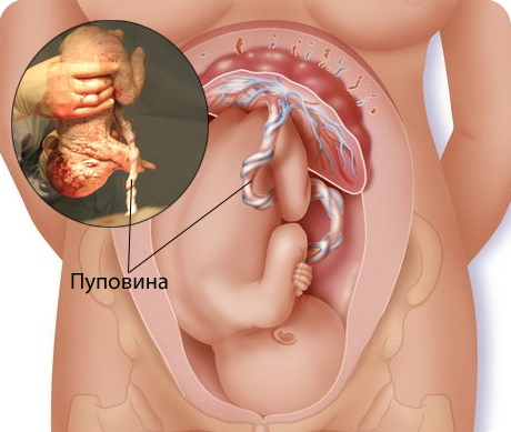 Положение плода