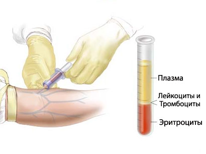 капустный отвар диета