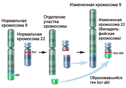 Филадельфийская хромосома