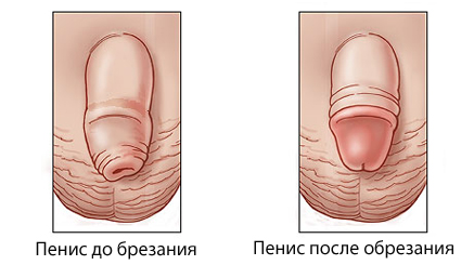          -  4