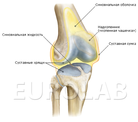 хондроматоз коленного сустава