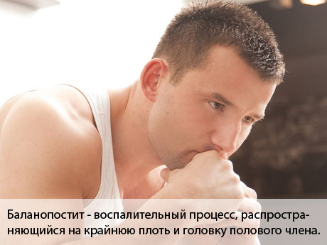 баланопостит