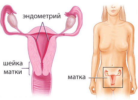 Лейомиосаркома матки лечение народными средствами thumbnail