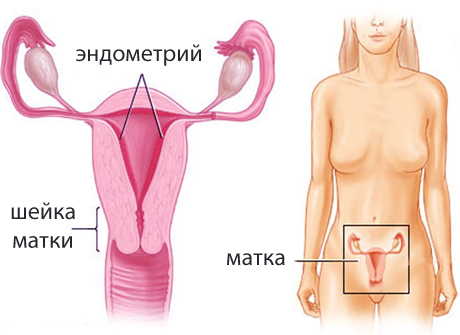 Лечение саркомы матки народными средствами thumbnail