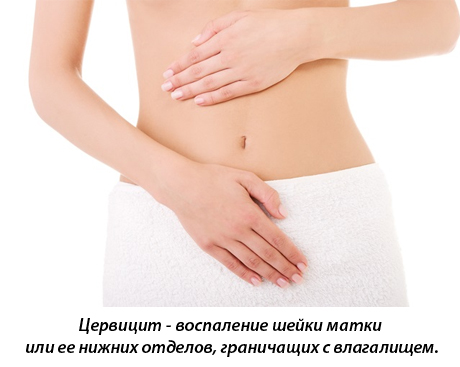 Лечение хронического цервицита в домашних условиях Лечение хронического цервицита в домашних условиях thumbnail