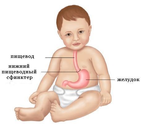 Изжога (ГЭРБ) у детей