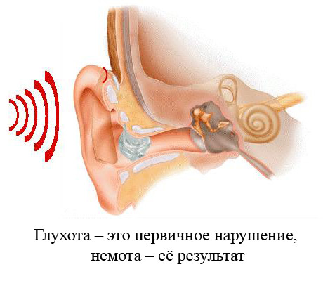 Как вылечить глухонемого человека