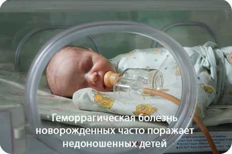 Геморрагическая болезнь новорожденных