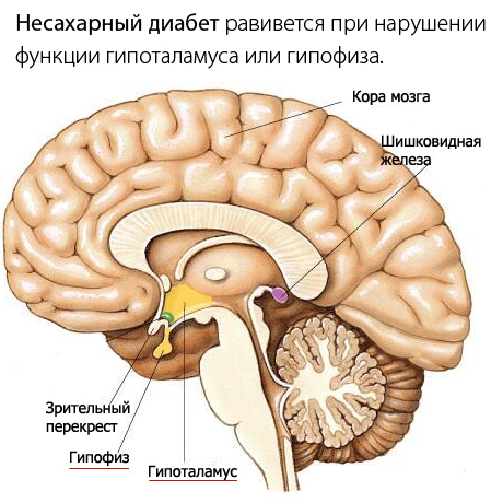 Несахарный диабет у детей