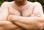 Чрезмерное увеличение молочных желез у мужчин.
Причиной гинекомастии считается чрезмерная выработка организмом эстрогена. Часто встречающаяся у мальчиков в период полового созревания, она проходит сама собой через несколько месяцев. Но может встречаться и у мужчин в более зрелом возрасте, что вызывается определенными медпрепаратами, проблемой печени или щитовидной железы или раком. Конечно, о серьезности этого явления можно говорить после врачебного обследования, но обычное увеличение молочных желез не опасно само по себе.