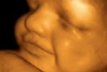 Развитие эмбриона на 24 неделе.
Вес ребенка уже 650 г. Ребенок реагирует на звуки учащенным сердцебиением или движениями. Когда он икает, можно ощутить некоторые его движения. В этот период уже полностью сформировалось внутреннее ухо и благодаря этому он уже понимает, находится ли он головой вниз или вверх.