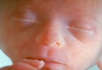 Развитие эмбриона на 20 неделе.
Вес ребенка около 255 г, а рост около 15 см. матка поднимается до уровня пупка. В этот период ребенок уже умеет сосать палец, зевать, потягиваться и корчить рожицы. Вскоре (если еще нет) – вы почувствуете первое шевеление малыша, что называется «начало шевеления плода».
