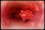 Что вызывает кровотечение во время дивертикулеза?
Кровотечение возникает, когда увеличенные дивертикулы врезаются в кровеносные сосуды. Больной может наблюдать выделение крови красного, густого или темно-коричневого цвета и сгустков крови без сопровождаемой боли в брюшной полости. Кровотечение может быть периодическое или постоянное (продолжающееся несколько дней). Если кровотечение длиться длительное время, больной должен быть госпитализирован для обследования. При постоянном и сильном кровотечении требуется незамедлительное хирургическое удаление дивертикул.