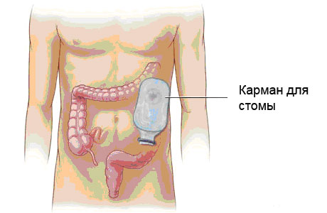 как приготовить картошку с курицей пошаговый рецепт