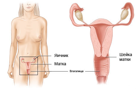 Как можно без лекарства вылечить молочницу