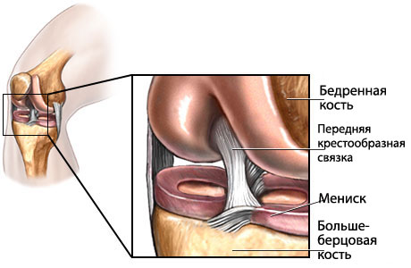 Передняя крестообразная связка коленного сустава суставит растение
